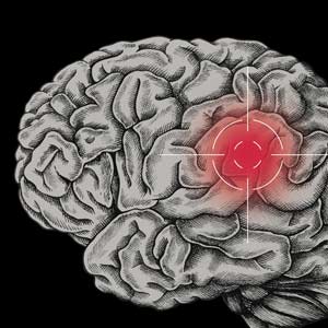 An illustration of a brain with a red targeted spot on it.
